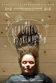 My Beautiful Broken Brain (2016)